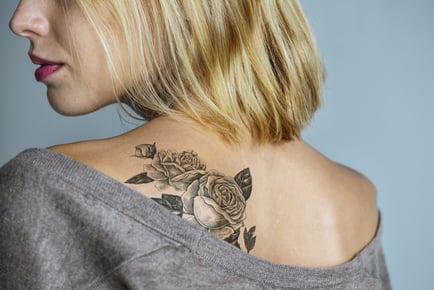 Laser Tattoo Removal - Small, Medium or Large Areas - 3 Sessions