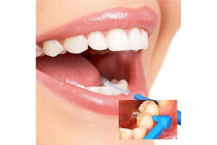 Interdental Brushes for Teeth Cleaning