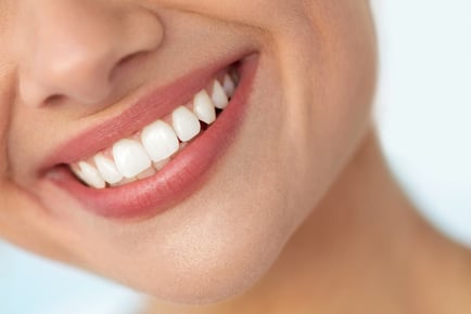 Teeth Whitening - Exeter, Pebble Brook Clinic