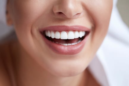 Naturawhite Teeth Whitening - Paradise Aesthetics - Nottingham