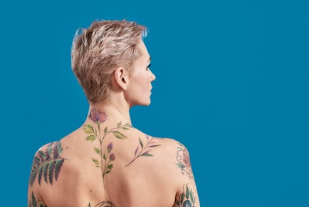 Laser Tattoo Removal at Body Perfections - 5 Options