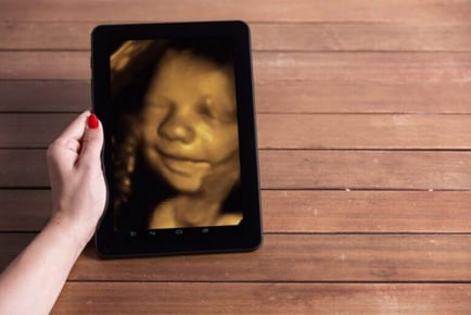 Early Pregnancy Scan with Pictures or 4D Digital Scan - Leicester City Centre