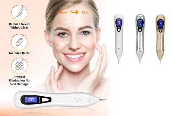 Portable-Skin-Tag-Remover-Pen-1