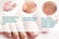 Ingrown-Toenail-Correction-Patch-Stickers-4