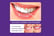 Purple-Teeth-Whitening-Colour-Correcting-Powder-3