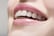 Dental Consultation - Wilton Dental Practice