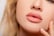 Lip Filler and Lip Blush Package - Permanent Aesthetics Studio - Derby