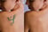 laser tattoo removal