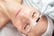 Facial Chemical Peel Treatment - Wembley