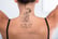 Laser Tattoo Removal - Skin Space UK - 7 Locations