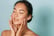 15-Min Chemical Peel – West Hampstead 