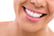 Queensway Dental Porcelain Veneer Voucher