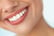 Teeth Whitening Voucher 