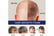 Extra-Strength-Hair-Loss-&-Hair-Growth-4