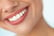 Teeth Whitening Makeover Consultation for 1 - Birmingham