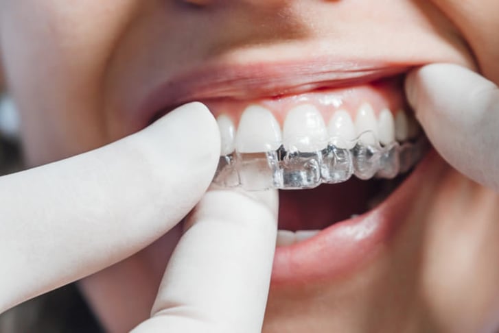 Clear Aligners  THE HAMPTONS DENTIST