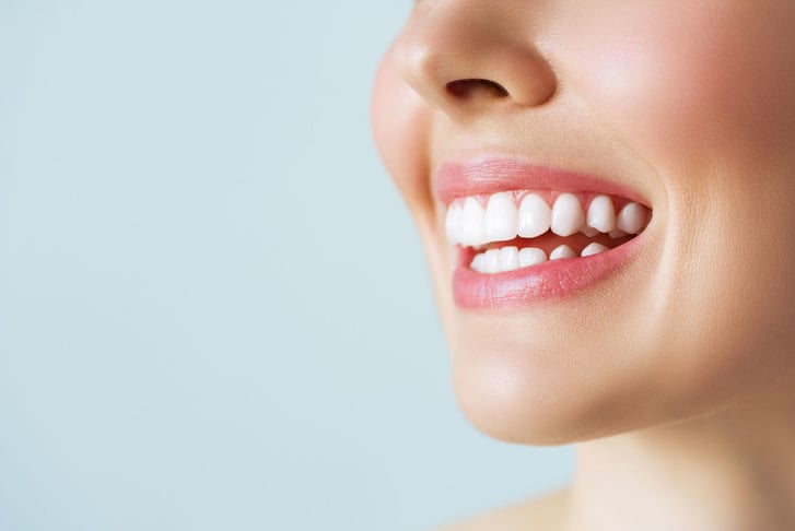 Teeth Whitening Treatment - Peach Pearl - Ruislip