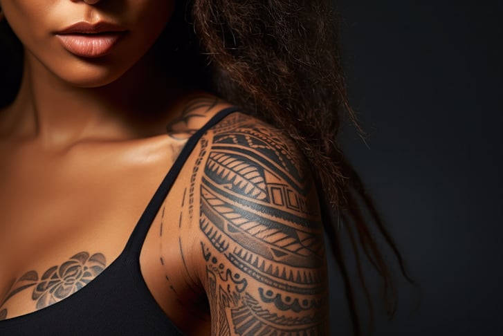Laser Tattoo Removal Package in Newcastle Deal - 3 Sessions