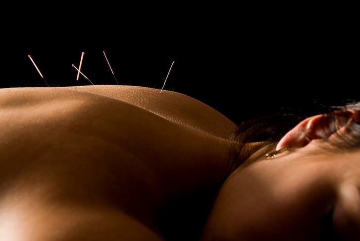 acupuncture-one