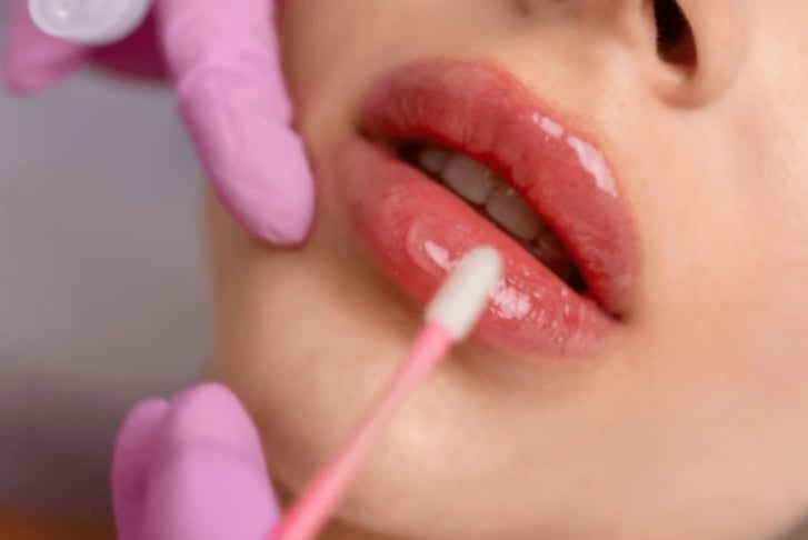 Lip Filler Stock Image