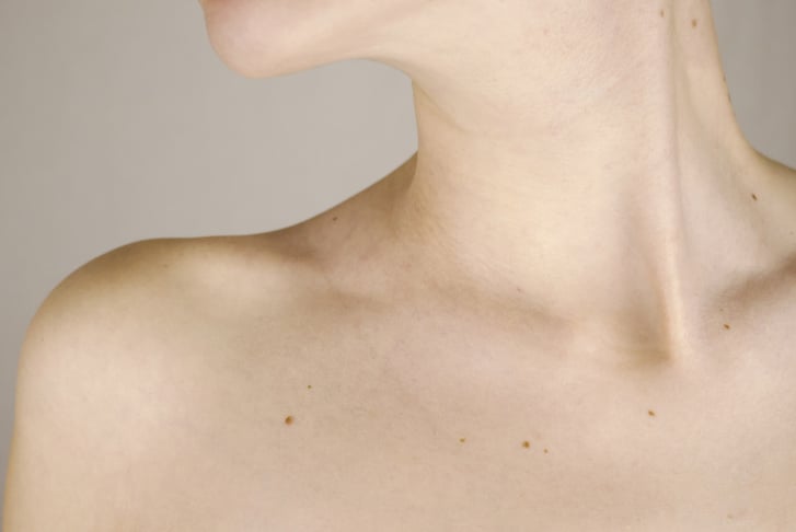 Skin Tags/Brown Spot/Milia Treatment