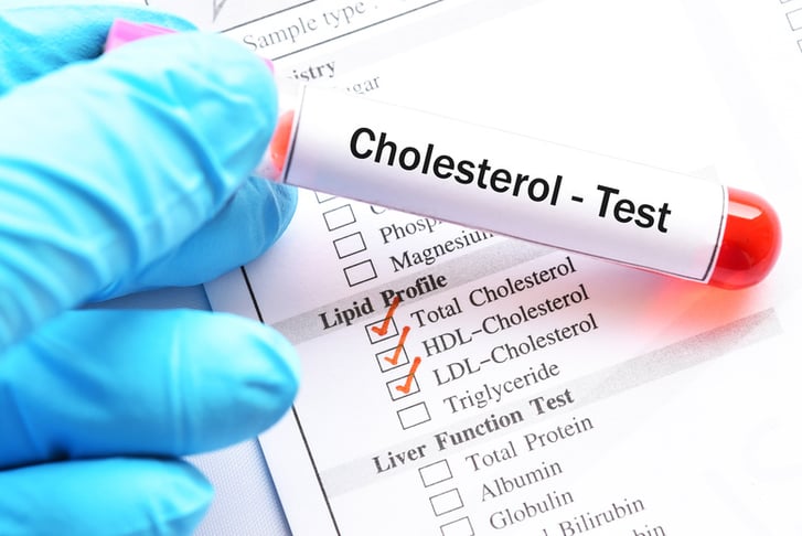 Newfoundland Cholesterol Test - 2 Pack Bundle