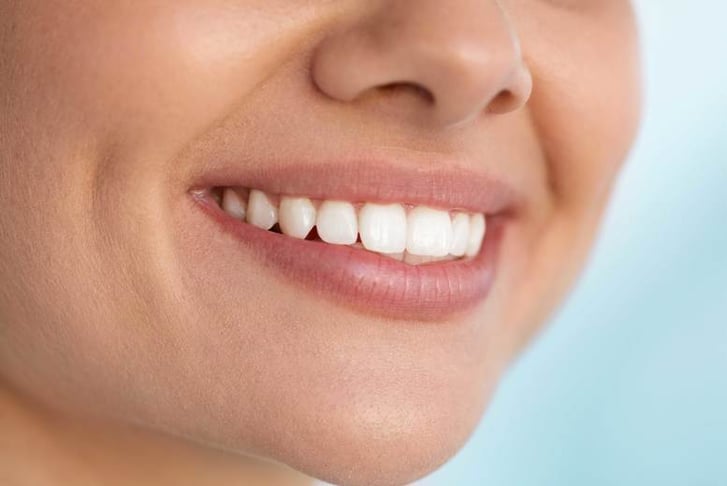 White teeth after LED whitening
