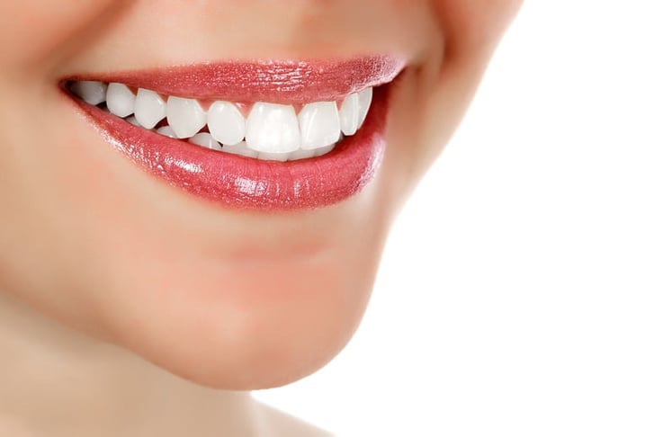 Laser Teeth Whitening Voucher