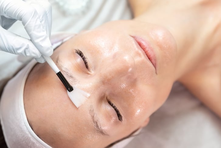 Multi-Acid Facial Peel - SkinSpaceUK - 8 Locations