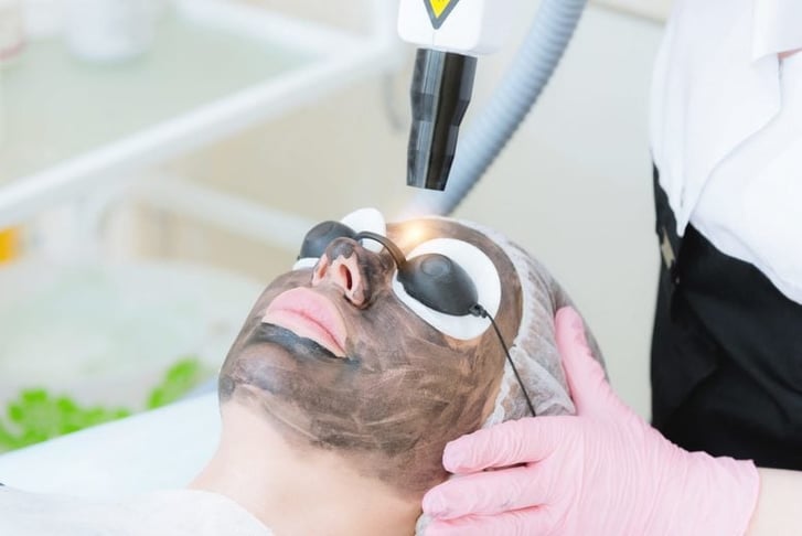 Carbon Laser Peel Facial 1