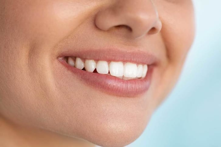 Laser Diamond Teeth Whitening - Solihull