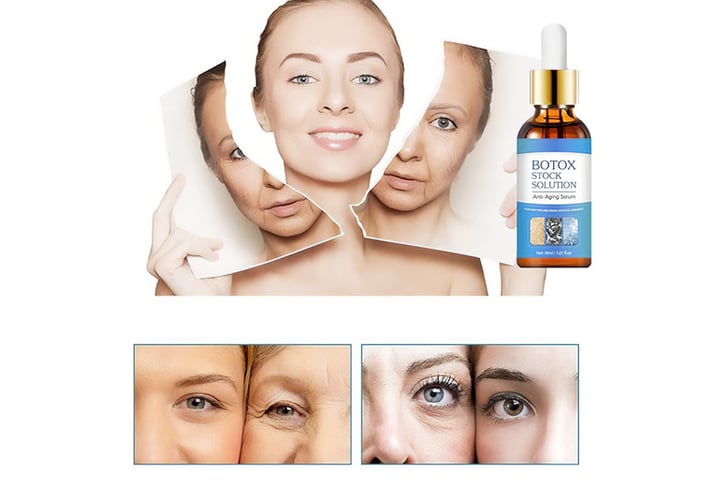 Botox-Anti-Wrinkle-Serum'-5