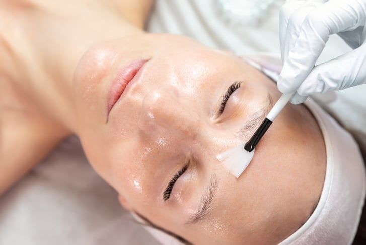 Chemical Peel Facial Treatment - London