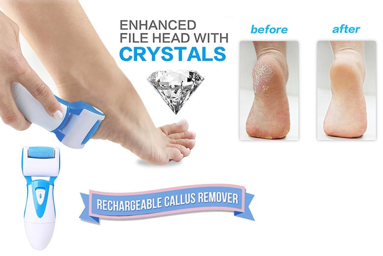 Electric Feet Hard Skin Remover Deal - Wowcher